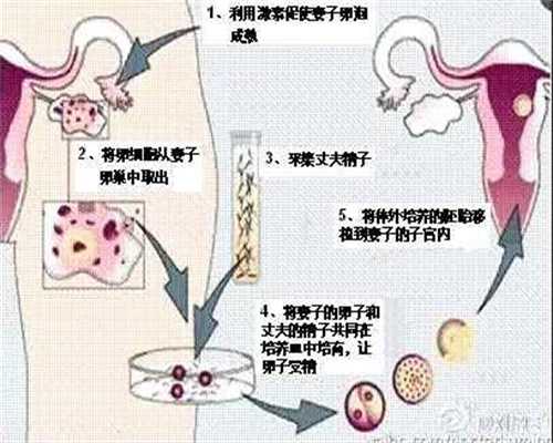 广州代孕中心官方网站_广州专业代怀孕套餐_广州
