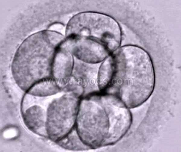 青岛借卵生子会有遗传病吗_试管婴儿胚胎等级是怎么划分的